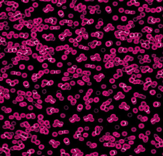 картинка Ковролин Flotex Sottsass Bacteria от Интернет-магазина Эллипс